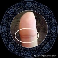 女人右手佛眼紋手相！