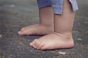 腳兩側長痣會帶來不好的影響嗎