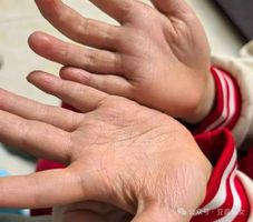 差的掌紋如何養成好的掌紋？