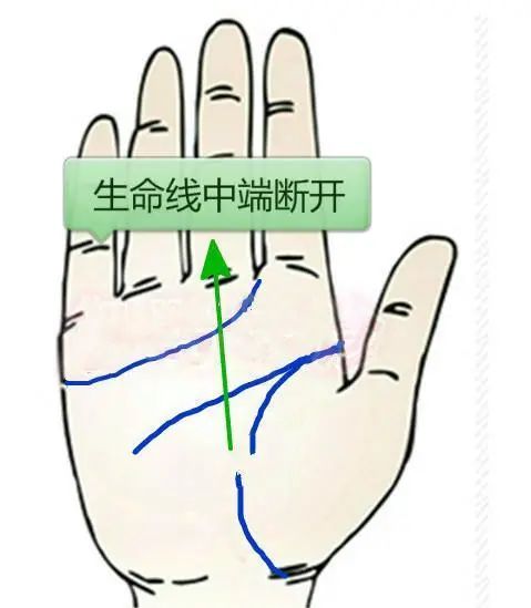 生命線