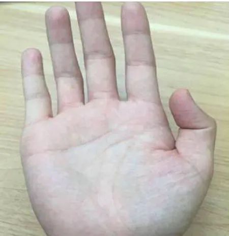 智慧線是看人智商的？如何看智慧線？