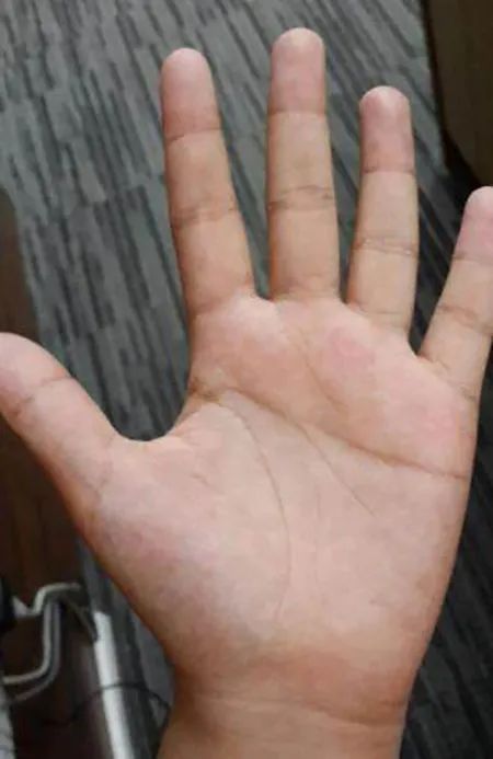 智慧線是看人智商的？如何看智慧線？