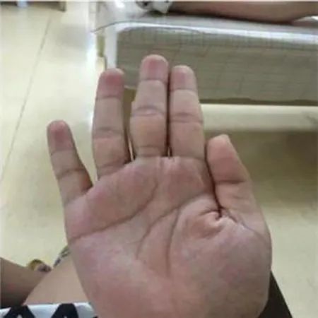 智慧線是看人智商的？如何看智慧線？